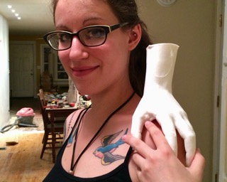 Stacy with cast of hand on shoulder