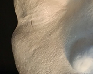 close up of glossy white plaster cast of young man's left eye and cheek showing an eyelash trapped in the plaster